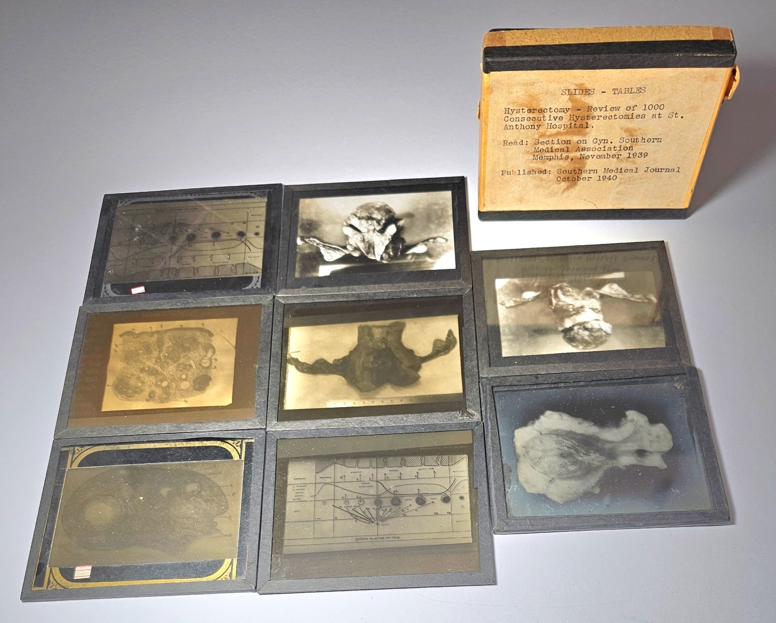 1939-41 Medical Glass Lantern Slides Dr Wendell Long St Anthony OKC Gyn/Hys 48